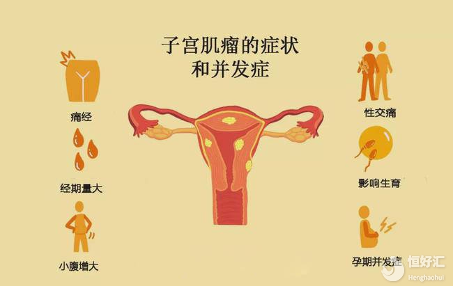 子宫肌瘤会影响怀孕并导致不孕吗？